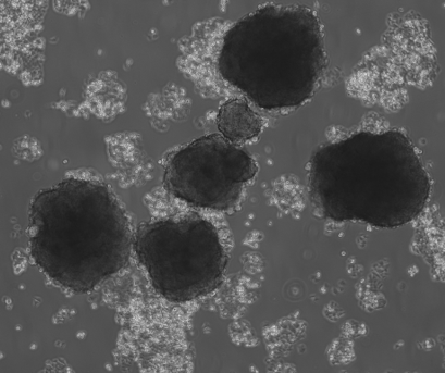 Pancreatic tumoroids observed for the ALATYR and Servier collaboration